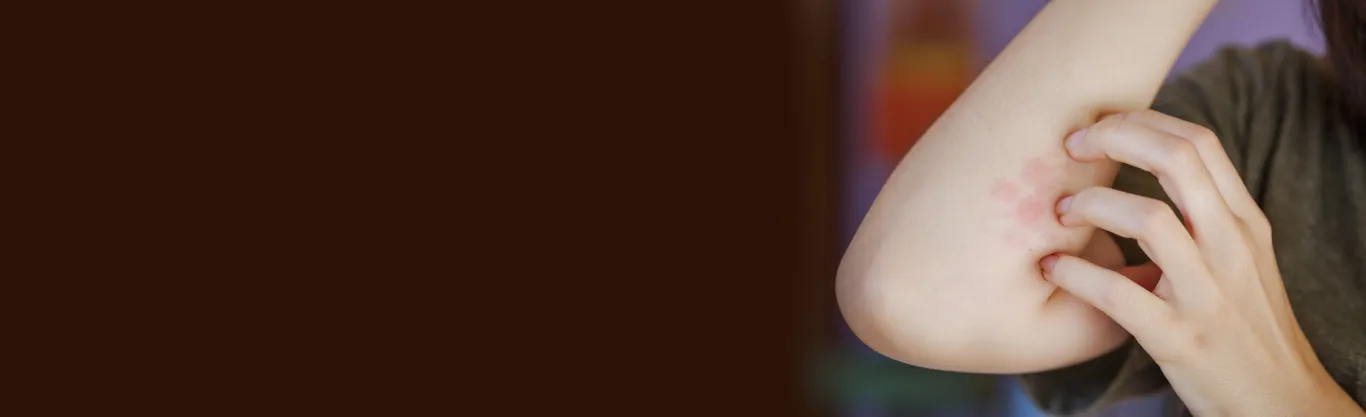 Hidradenitis Suppurativa