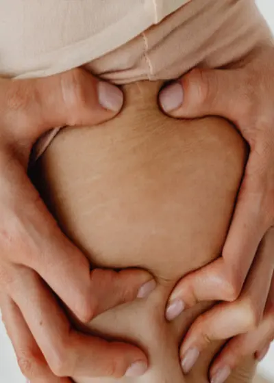 Signs of Stretch Marks: Signs of stretch marks include sunken lines on the skin, discoloration, itchiness, and the skin becoming glossy or having white/ silver streaks.