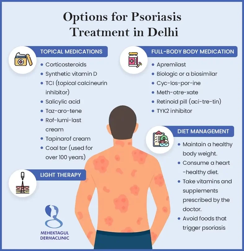 Psoriasis Treatment in Delhi: Treatment options for psoriasis includes Topical Medications, Light Therapy, Full-body Body Medication, and Diet Management.