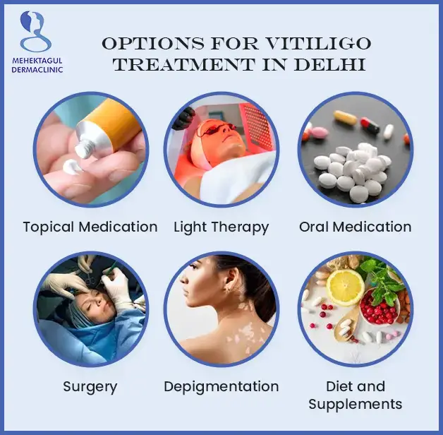 Vitiligo treatment in Delhi: Treatment options for Vitiligo includes Topical Medication, Light Therapy, Oral Medication, and etc. 